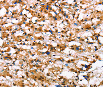 Anti-DGAT1 antibody produced in rabbit affinity isolated antibody