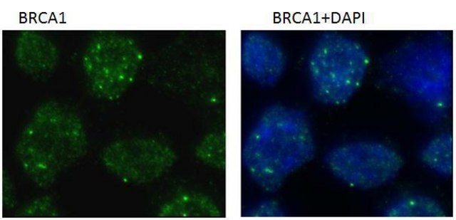 Monoclonal Anti-BRCA1 antibody produced in mouse