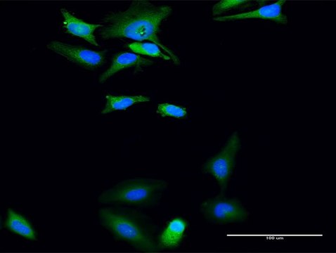 Anti-UGP2 antibody produced in rabbit purified immunoglobulin, buffered aqueous solution