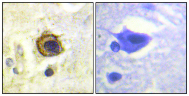 Anti-PDGFR &#946; antibody produced in rabbit affinity isolated antibody