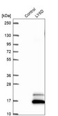 Anti-LY6D antibody produced in rabbit Prestige Antibodies® Powered by Atlas Antibodies, affinity isolated antibody, buffered aqueous glycerol solution