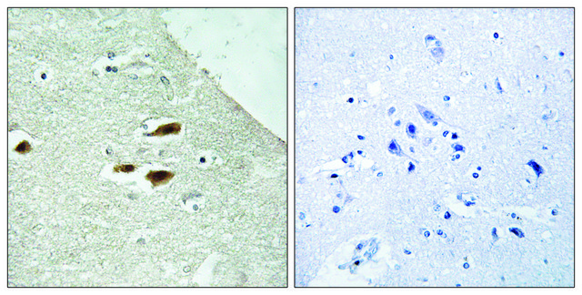 Anti-Period Circadian Protein 2 (Phospho-SER662) affinity isolated antibody