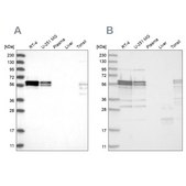 Anti-ZC3H15 antibody produced in rabbit Prestige Antibodies® Powered by Atlas Antibodies, affinity isolated antibody, buffered aqueous glycerol solution, ab2