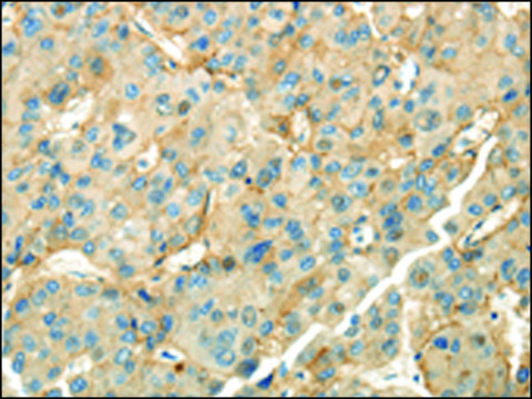 Anti-CD70 affinity isolated antibody