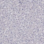 Anti-ADAM28 antibody produced in rabbit Prestige Antibodies® Powered by Atlas Antibodies, affinity isolated antibody