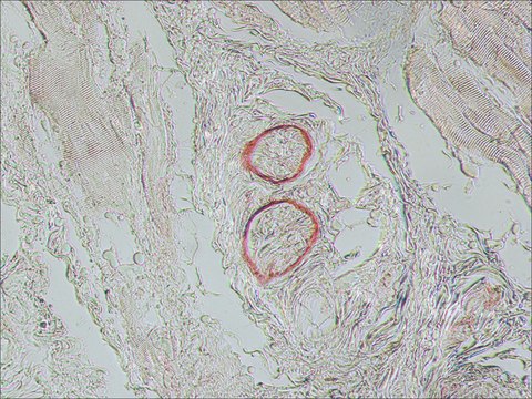 Monoclonal Anti-Nerve Growth Factor Receptor (NGFR p75) antibody produced in mouse clone ME20.4, ascites fluid