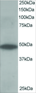 Anti-ORP1 antibody produced in goat affinity isolated antibody, buffered aqueous solution