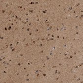 Anti-RAB3GAP2 antibody produced in rabbit Prestige Antibodies® Powered by Atlas Antibodies, affinity isolated antibody, buffered aqueous glycerol solution, Ab1