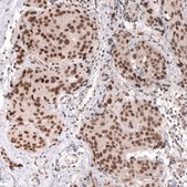 Monoclonal Anti-Mlh3 Antibody Produced In Mouse Prestige Antibodies® Powered by Atlas Antibodies, clone CL14084, affinity isolated antibody, buffered aqueous glycerol solution