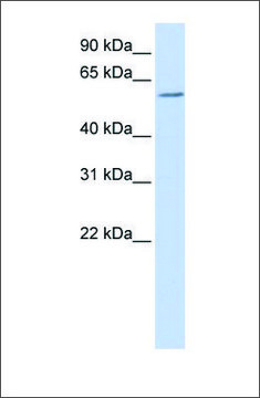 Anti-ZBTB7A antibody produced in rabbit affinity isolated antibody