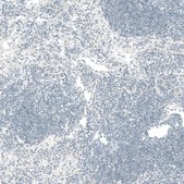 Monoclonal Anti-CTGF antibody produced in mouse Prestige Antibodies® Powered by Atlas Antibodies, clone CL5339, purified immunoglobulin, buffered aqueous glycerol solution
