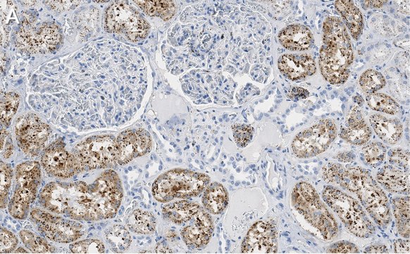 Anti-Cathepsin L1 Antibody, clone 1G2 ZooMAb&#174; Rabbit Monoclonal recombinant, expressed in HEK 293 cells