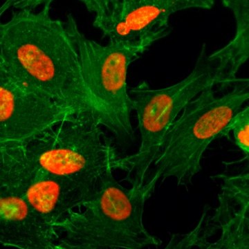 Anti-Acetyl-Histone H3 (Lys36) antibody, Rabbit monoclonal recombinant, expressed in HEK 293 cells, clone RM154, purified immunoglobulin