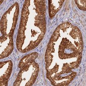 Anti-HN1L antibody produced in rabbit Prestige Antibodies® Powered by Atlas Antibodies, affinity isolated antibody, buffered aqueous glycerol solution