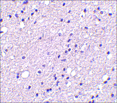 Anti-NK3R antibody produced in rabbit affinity isolated antibody, buffered aqueous solution