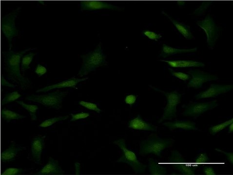 Monoclonal Anti-LYPLA1 antibody produced in mouse clone 3D5, purified immunoglobulin, buffered aqueous solution