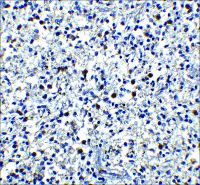 Anti-Cathelicidin antibody produced in rabbit affinity isolated antibody, buffered aqueous solution