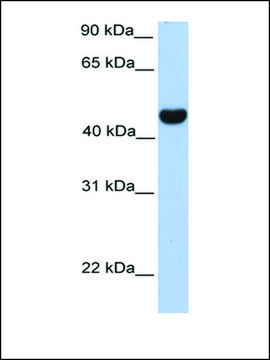 Anti-RTN4 (AB1) antibody produced in rabbit affinity isolated antibody