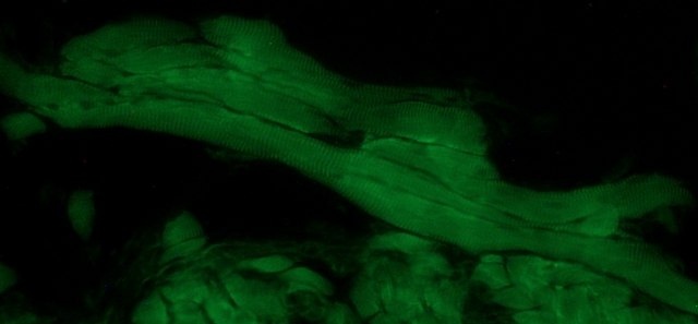 Anti-Myopodin antibody produced in rabbit affinity isolated antibody, buffered aqueous solution