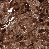 Anti-WFDC2 antibody produced in mouse Prestige Antibodies® Powered by Atlas Antibodies, clone CL12886, purified by using Protein A, buffered aqueous glycerol solution