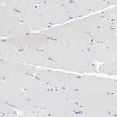 Anti-SLPI antibody produced in rabbit Prestige Antibodies® Powered by Atlas Antibodies, affinity isolated antibody, buffered aqueous glycerol solution