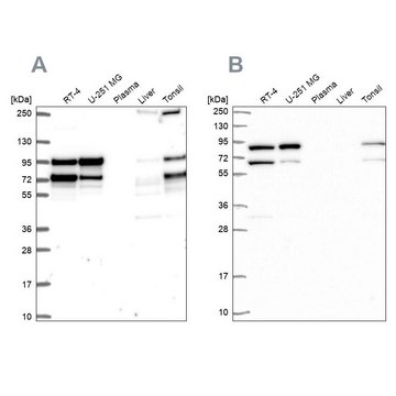 Anti-RANGAP1 antibody produced in rabbit Prestige Antibodies&#174; Powered by Atlas Antibodies, affinity isolated antibody