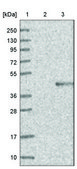 Anti-DGAT2 antibody produced in rabbit Prestige Antibodies® Powered by Atlas Antibodies, affinity isolated antibody, buffered aqueous glycerol solution