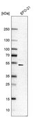 Anti-PRCP antibody produced in rabbit Prestige Antibodies® Powered by Atlas Antibodies, affinity isolated antibody, buffered aqueous glycerol solution