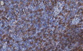Anti-CD20 Antibody, clone 1E10 ZooMAb® Rabbit Monoclonal recombinant, expressed in HEK 293 cells