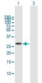 Anti-FAM60A antibody produced in mouse purified immunoglobulin, buffered aqueous solution