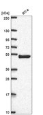Anti-Ap1M2 Antibody Produced In Rabbit Prestige Antibodies® Powered by Atlas Antibodies, affinity isolated antibody, buffered aqueous glycerol solution