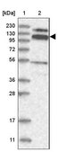 Anti-RBM15B antibody produced in rabbit Prestige Antibodies® Powered by Atlas Antibodies, affinity isolated antibody, buffered aqueous glycerol solution