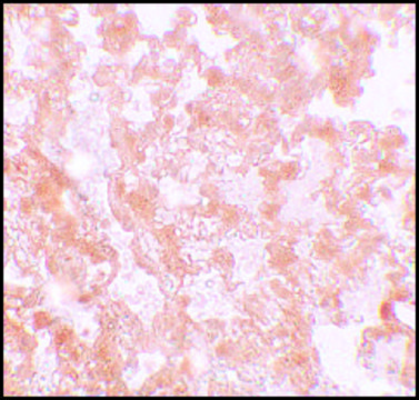 Anti-MFSD2A antibody produced in rabbit affinity isolated antibody, buffered aqueous solution