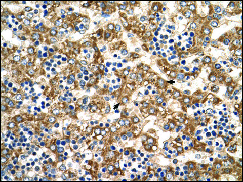 Anti-HADHB affinity isolated antibody