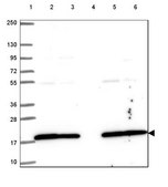 Anti-UBE2L3 antibody produced in rabbit Prestige Antibodies® Powered by Atlas Antibodies, affinity isolated antibody, buffered aqueous glycerol solution
