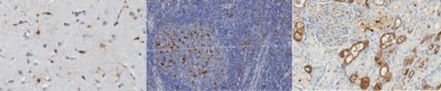 Anti-ZBTB46 (ZNF340) Antibody, clone 5A8.1 clone 5A8.1, from mouse