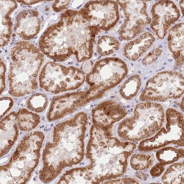 Anti-TIMM13 antibody produced in rabbit Prestige Antibodies&#174; Powered by Atlas Antibodies, affinity isolated antibody, buffered aqueous glycerol solution