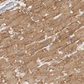 抗-ADAMTS9 兔抗 Prestige Antibodies® Powered by Atlas Antibodies, affinity isolated antibody, buffered aqueous glycerol solution, ab1