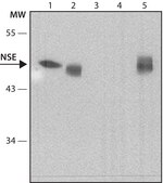 Anti-Neuron-Specific Enolase (NSE) antibody, Mouse monoclonal clone NSE-P2, purified from hybridoma cell culture