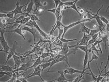 MS5-mDLL1 Stromal Cell Line The MS5-mDLL1 stromal cell line is used in a serum-free artificial thymic organoid (ATO) system to generate mature T-cells from human hematopoietic stem and progenitor cells.