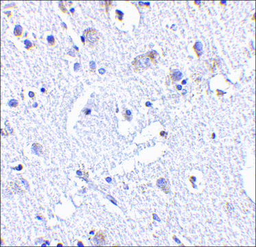 Anti-TIGAR (ab2) antibody produced in rabbit affinity isolated antibody, buffered aqueous solution