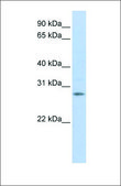 Anti-IGFBP4 antibody produced in rabbit affinity isolated antibody