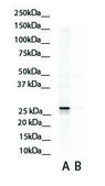 Anti-ASPH affinity isolated antibody