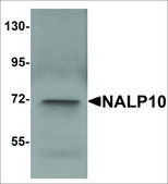 Anti-NALP10 antibody produced in rabbit affinity isolated antibody, buffered aqueous solution