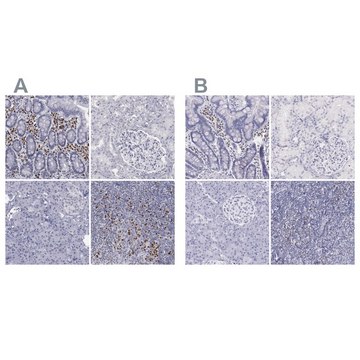 Anti-IRF4 antibody produced in rabbit Ab1, Prestige Antibodies&#174; Powered by Atlas Antibodies, affinity isolated antibody, buffered aqueous glycerol solution