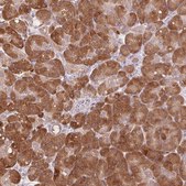 Anti-TMED6 antibody produced in rabbit Prestige Antibodies® Powered by Atlas Antibodies, affinity isolated antibody, buffered aqueous glycerol solution