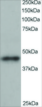 Anti-ARP1 homolog B antibody produced in goat affinity isolated antibody, buffered aqueous solution