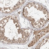 Anti-STRAP antibody produced in rabbit Prestige Antibodies® Powered by Atlas Antibodies, affinity isolated antibody, buffered aqueous glycerol solution