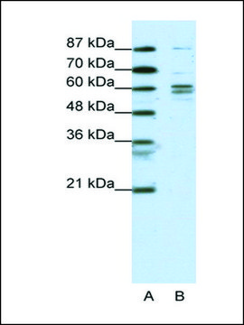 Anti-GTF2F1 antibody produced in rabbit affinity isolated antibody