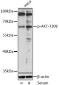 Anti-Phospho-AKT1-T308 antibody produced in rabbit